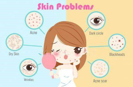 product-500-320 Help skin condition